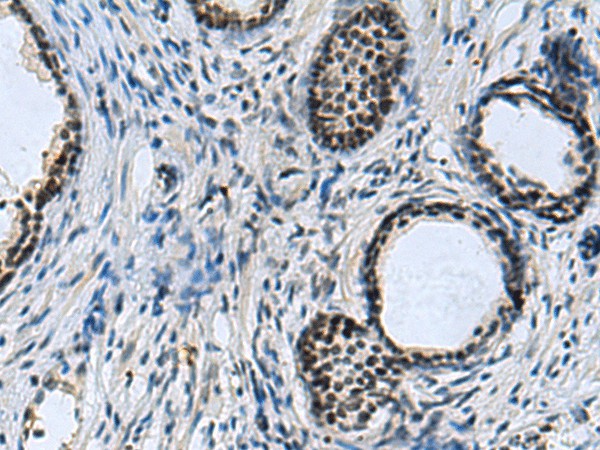 CCAR2 Polyclonal Antibody (E-AB-52105)