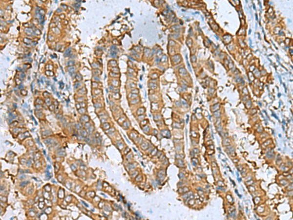 DPYSL3 Polyclonal Antibody (E-AB-52640)