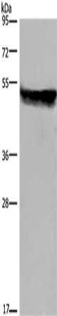 CYP2E1 Polyclonal Antibody (E-AB-14909)