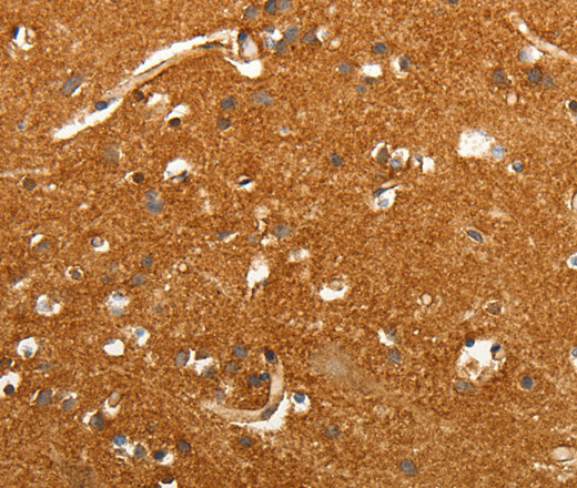 SLC4A4 Polyclonal Antibody (E-AB-10595)