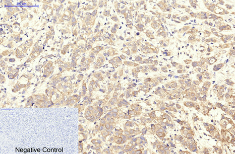 ITGA2B Monoclonal Antibody (E-AB-22101)