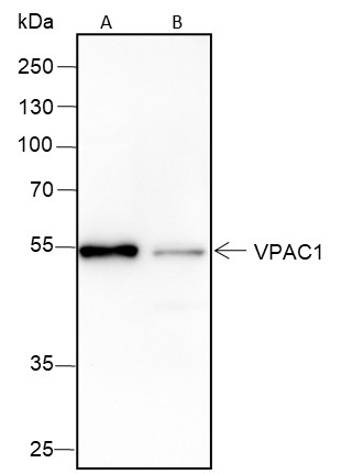 Recombinant VPAC1 Monoclonal Antibody (AN301687L)