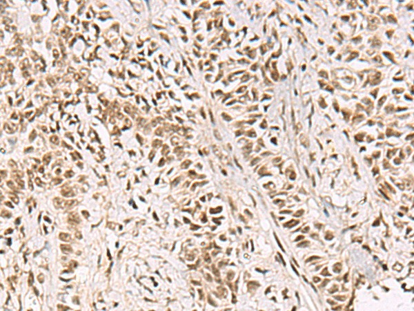 GABPB1 Polyclonal Antibody (E-AB-52928)
