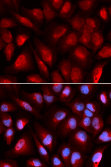 MCM5 Polyclonal Antibody (E-AB-61010)