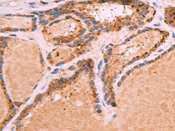 GPC2 Polyclonal Antibody (E-AB-53439)