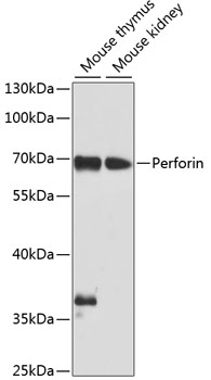 Perforin Polyclonal Antibody (E-AB-65660)