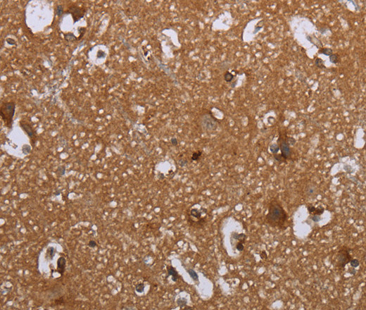 LIMK1 Polyclonal Antibody (E-AB-13381)