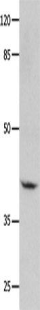 GNA11 Polyclonal Antibody (E-AB-14087)