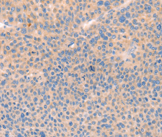 CD109 Polyclonal Antibody (E-AB-12769)