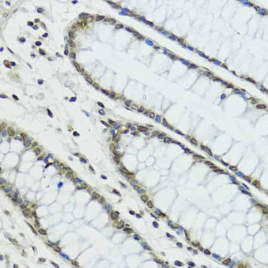 TRIP12 Polyclonal Antibody (E-AB-62305)