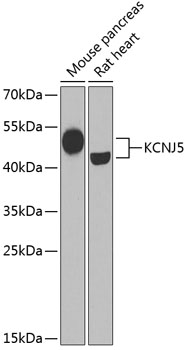 KCNJ5 Polyclonal Antibody (E-AB-62113)