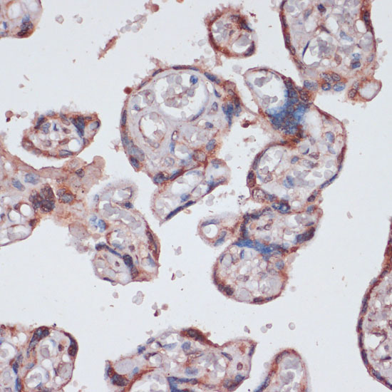 RPS13 Polyclonal Antibody (E-AB-66548)