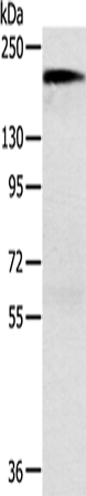 ACE1 Polyclonal Antibody (E-AB-15454)
