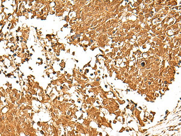 TCF7 Polyclonal Antibody (E-AB-53275)