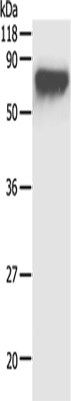 AFP Polyclonal Antibody (E-AB-13797)