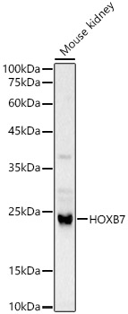HOXB7 Polyclonal Antibody (E-AB-68396)