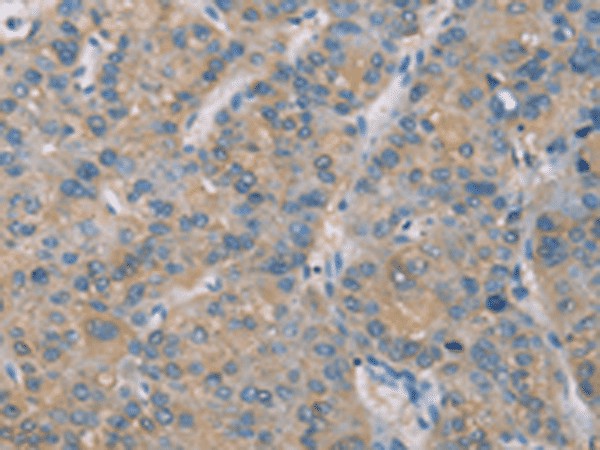 ZBTB6 Polyclonal Antibody (E-AB-53228)