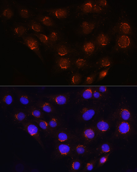 GOLGA4 Polyclonal Antibody (E-AB-63302)