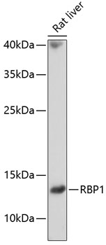 RBP1 Polyclonal Antibody (E-AB-65728)