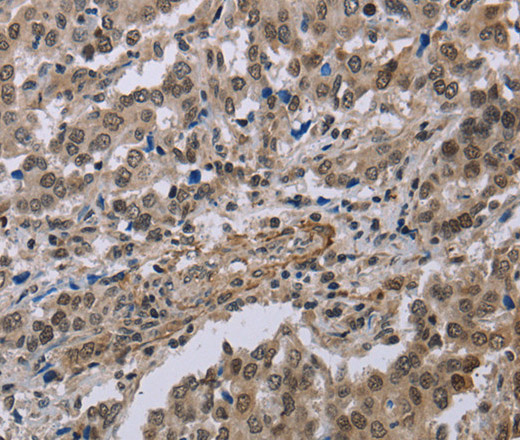 MGLL Polyclonal Antibody (E-AB-16617)