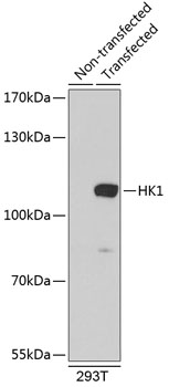 HK1 Polyclonal Antibody (E-AB-90020)