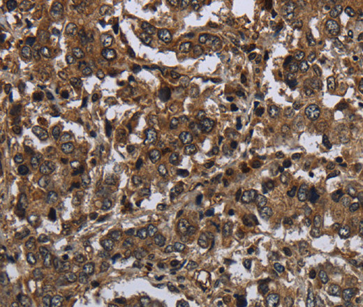 GLIPR1 Polyclonal Antibody (E-AB-15071)