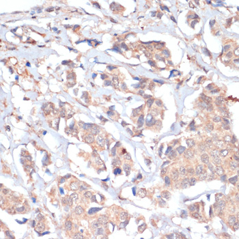 PRMT7 Polyclonal Antibody (E-AB-67068)