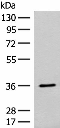 FAM84A Polyclonal Antibody (E-AB-19848)