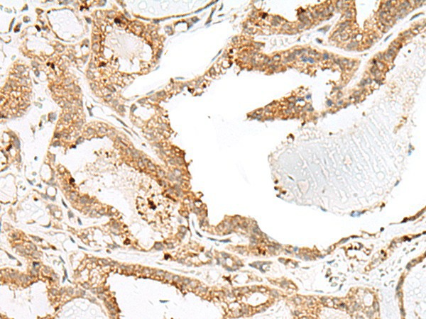 ENAH Polyclonal Antibody (E-AB-18029)