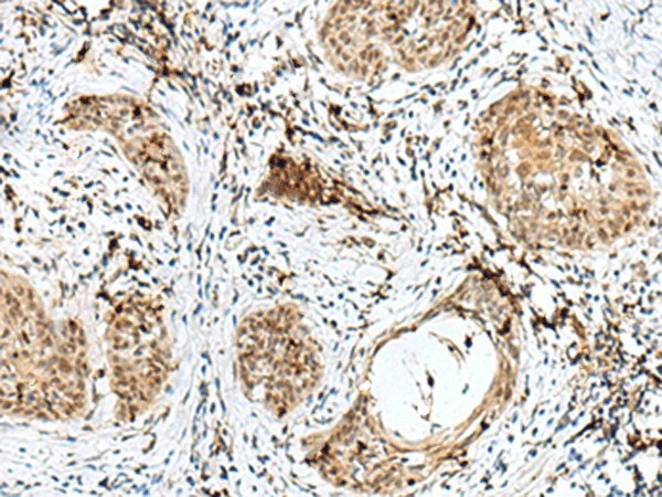 RBM15 Polyclonal Antibody (E-AB-52783)