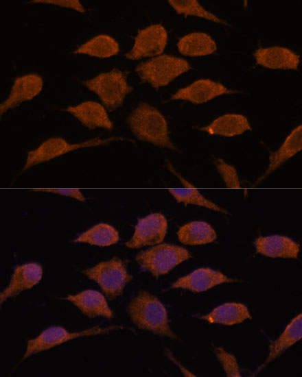 USP19 Polyclonal Antibody (E-AB-65638)
