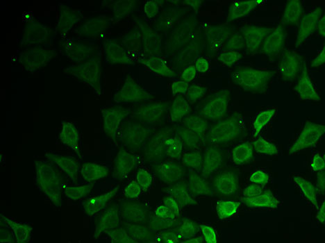 (KO Validated) C21orf33 Polyclonal Antibody (E-AB-61956)