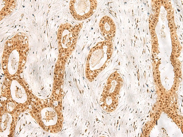 RPS27A Polyclonal Antibody (E-AB-18908)