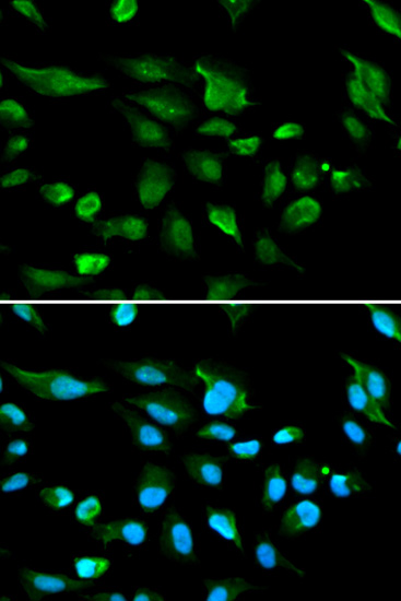 AIRE Polyclonal Antibody (E-AB-60437)