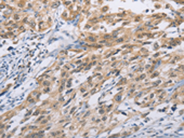 ZIC5 Polyclonal Antibody (E-AB-53239)