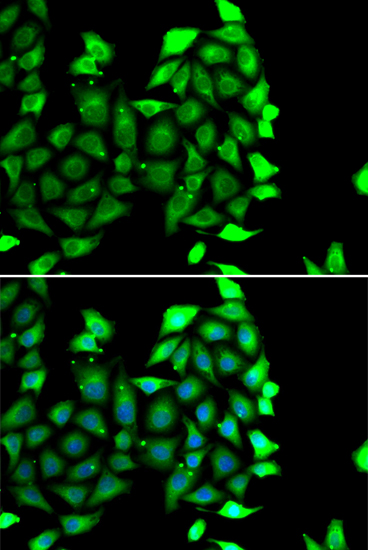 IKZF3 Polyclonal Antibody (E-AB-61621)