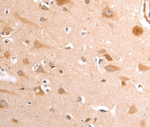TRPV4 Polyclonal Antibody (E-AB-14424)