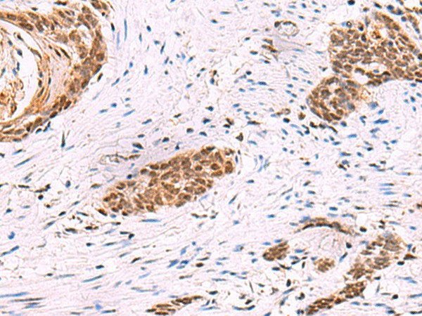 CREBBP Polyclonal Antibody (E-AB-18158)