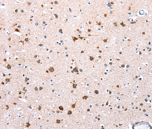 NDUFA12 Polyclonal Antibody (E-AB-15597)