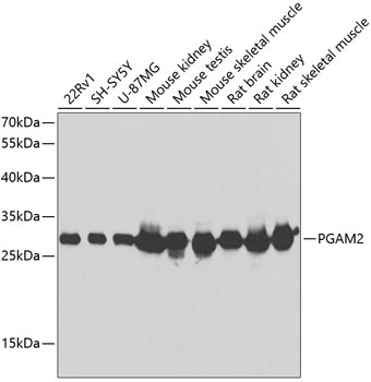 PGAM2 Polyclonal Antibody (E-AB-62866)
