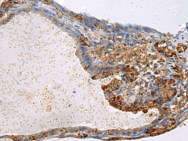 GNAI1 Polyclonal Antibody (E-AB-53168)