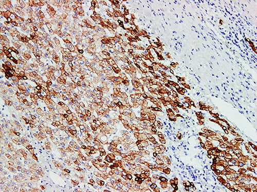 CK18 Monoclonal Antibody (ELAB6166-M)
