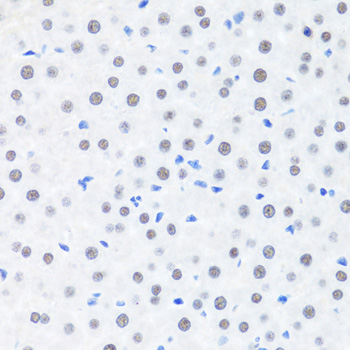 BRMS1 Polyclonal Antibody (E-AB-65136)