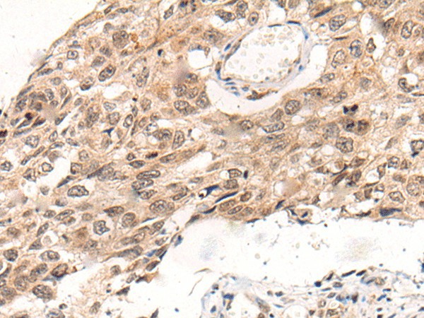 KNOP1 Polyclonal Antibody (E-AB-17746)