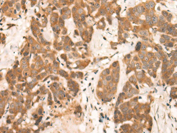 NRG2 Polyclonal Antibody (E-AB-19325)