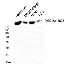 RYR2 Polyclonal Antibody (E-AB-32840)