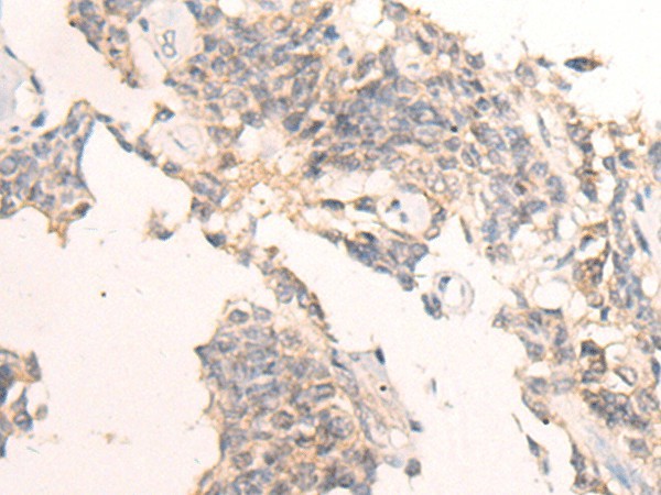 IBA57 Polyclonal Antibody (E-AB-19641)