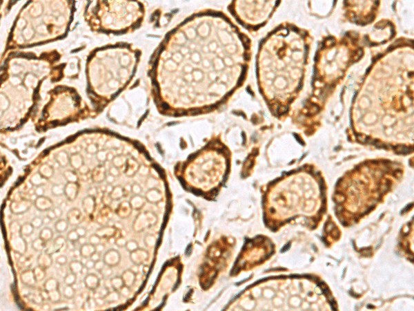 LRRC2 Polyclonal Antibody (E-AB-18432)