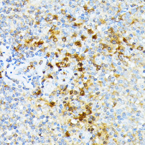 SPTA1 Polyclonal Antibody (E-AB-63689)