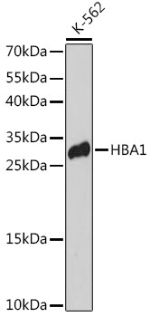 HBA1 Polyclonal Antibody (E-AB-66307)